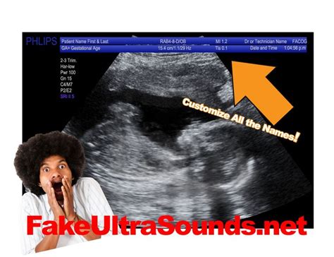 Fake Sonogram Generator Free